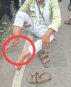 परिवर्तन चौराहे से कैसरबाग जाने के लिए बस पर चढ़ते समय युवक हुआ घायल