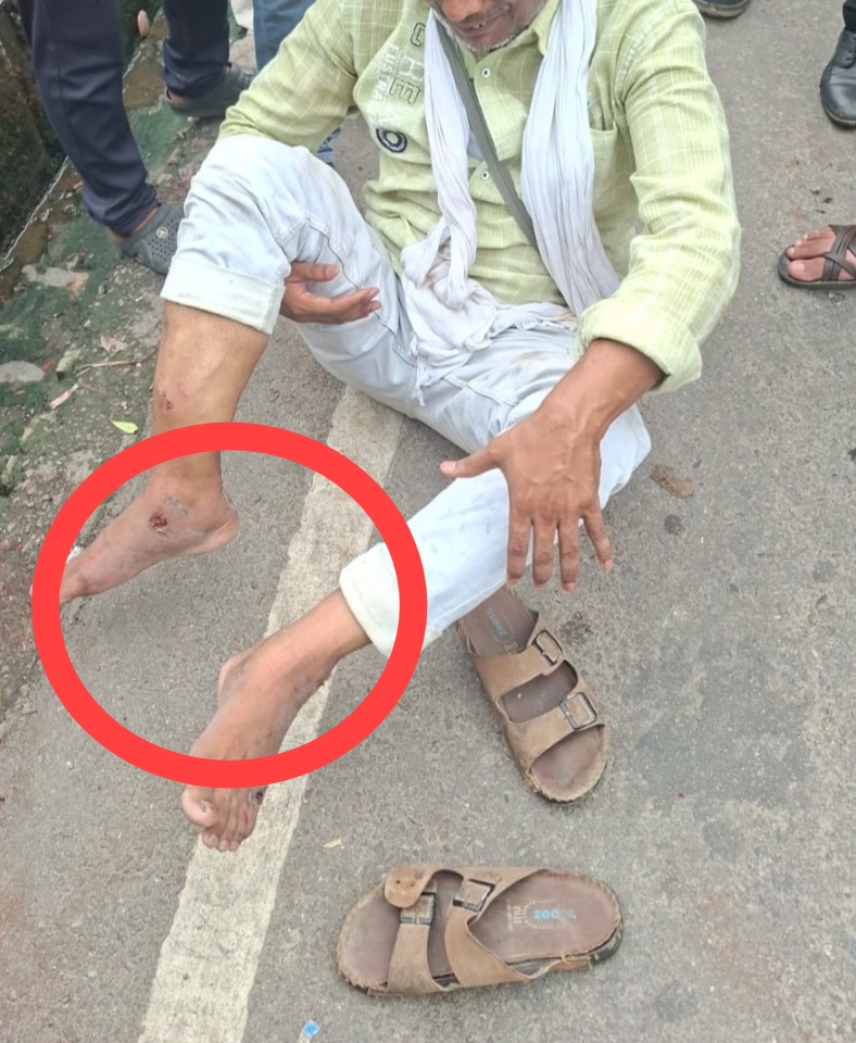 परिवर्तन चौराहे से कैसरबाग जाने के लिए बस पर चढ़ते समय युवक हुआ घायल